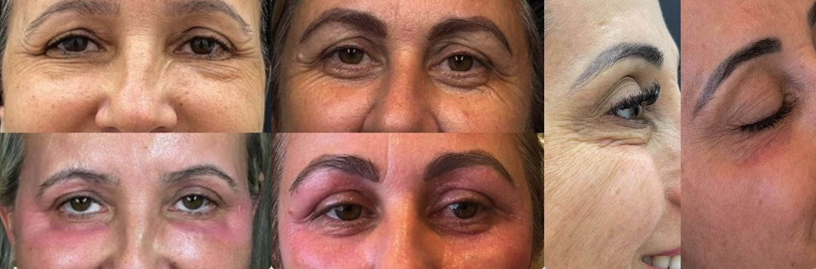 Resultados antes e depois de pacientes da Dra. Rosana Vecchi Caldas